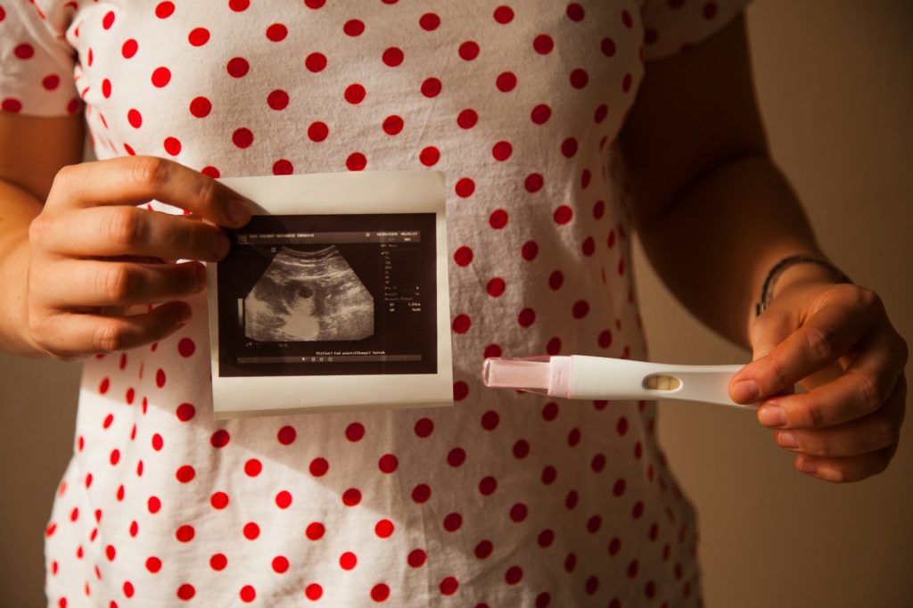 Pregnancy concept