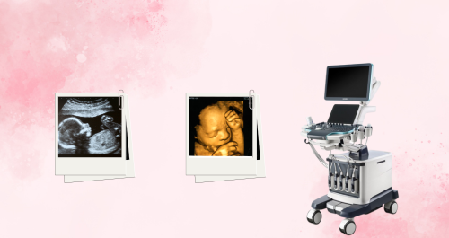 Maternal Fetal Medicine Scanning (500 x 265 px) 01 Maternal Fetal Medicine Scanning (500 x 265 px) 01